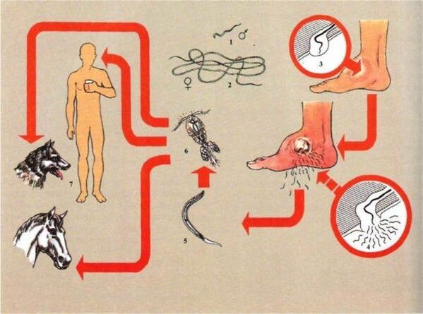 Rozwój drakunculozy